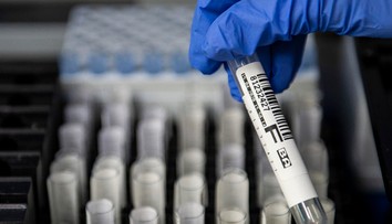 Objavili desiatky mutácií vírusu. Najničivejší kmeň zabíja ľudské bunky najrýchlejšie