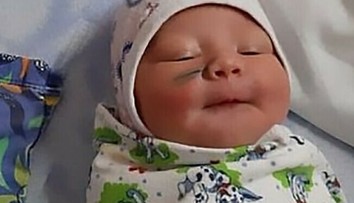Zhrozená matka zostala po pôrode v šoku: Bábätko malo na líci škaredú jazvu