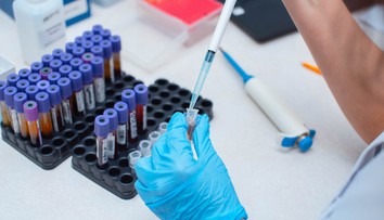 Prelomový liek na HIV je objavom minulého roka. Vírus však stále nedokáže vyliečiť