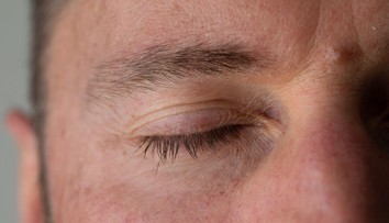 Sociálnymi sieťami sa šíri bizarný trend. Muži si skracujú alebo holia mihalnice