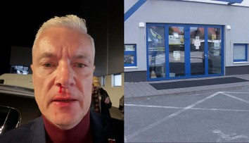 Zvrat v prípade napadnutia Ferenčáka. Polícia má niečo, čo môže objasniť celý útok