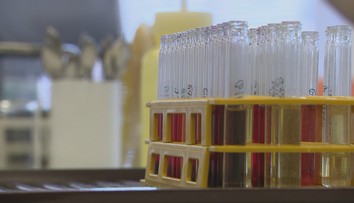 Kontaminácia pesticídmi: Ako obstáli v testoch slovenské potraviny v porovnaní so zahraničnými?