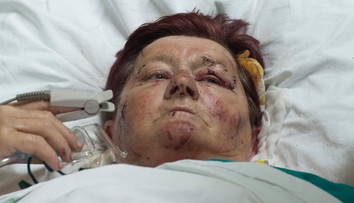 Helena prežila nehodu autobusu, no zostáva v srbskej nemocnici