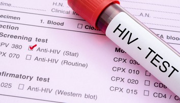 Epidémia AIDS je s nami už 35 rokov, ako prví jej podľahli homosexuáli