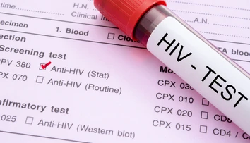 Epidémia AIDS je s nami už 35 rokov, ako prví jej podľahli homosexuáli
