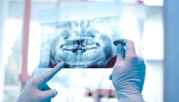 Muž prišiel pri zákroku na klinike v Turecku o všetky zuby. Príbeh sa skončil obrovskou tragédiou