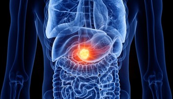 Rakovina pankreasu je jedným z najzákernejších onkologických ochorení. Týchto desať príznakov by ste nemali ignorovať