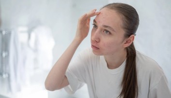 Akné nie je len pubertálny problém. Dermatologička radí, na čo si dať pozor
