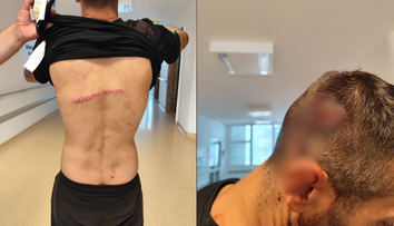 Hovorili sme s rodičmi muža, ktorého mal zmlátiť policajt. Po výsluchu ho ani nespoznali