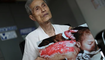 Zomrel Sumiteru Taniguči, ktorý prežil útok atómovou bombou na Nagasaki