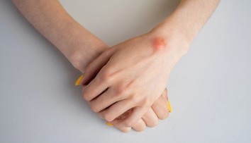 Nahmatali ste si hrčku pod kožou? Jeden detail prezradí viac než si myslíte