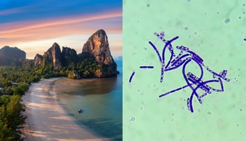 Obľúbená dovolenková destinácia bojuje so zákernou nákazlivou chorobou. Hlásia už aj mŕtveho