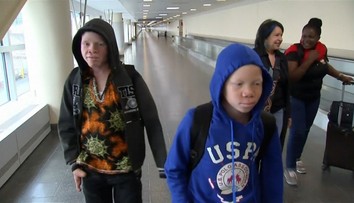 Albínske deti unikli pred smrťou. Znetvorili ich pre povery