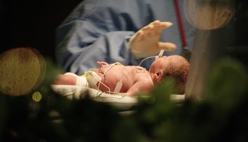 Francúzov vystrašili prípady detí, ktoré sa narodili so zdeformovanými alebo chýbajúcimi končatinami