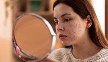 Bežné príznaky na tvári signalizujú vážny problém s hladinou cukru. Lekár vymenoval, čo si musíte všímať