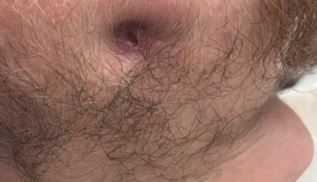 Strach zo zubárov ho stál veľa: Zanedbaný zubný kaz spôsobil mladému mužovi hotové peklo