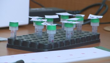 HIV sa čoraz častejšie šíri medzi heterosexuálmi. Pozreli sme sa na situáciu na Slovensku