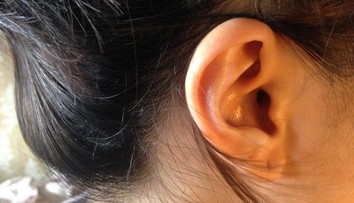 Zapálila sa vám dierka? Pomôže náušnica zo vzácneho kovu