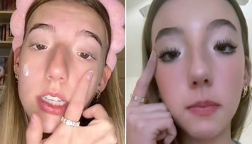 Narodila sa bez dôležitého svalu v tvári a tri roky nevedela žmurkať. Za jej výzor ju šikanovali v škole aj na pracovisku