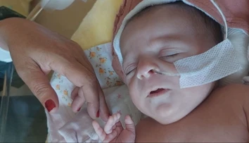 Siamské dvojčatá presunuli z Bratislavy. Lekári prezradili, ako sa dievčatám darí