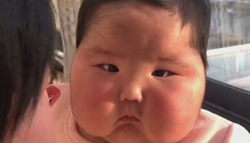 Žena zostala v šoku, keď sa dcére nafúkla tvár a začali jej na nej rásť vlasy. Za všetko môže krém