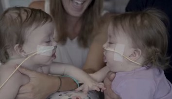 Lekári sa báli, že sa nemusia dožiť operácie. Teraz tieto siamské dvojičky úspešne oddelili