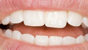 Páchne vám z úst? Môže to byť vážne