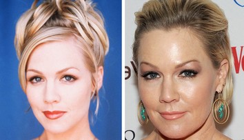 Aj ona podľahla plastike. Kelly z Beverly Hills natiahnutá a pribratá