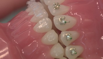 Dajte si pozor, kto vám robí zubný strojček. Pre peniaze to robia aj lekári, ktorí na to nemajú vzdelanie