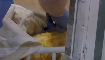 Dievčatko pri požiari utrpelo popáleniny na polovici tela. V dome ho zabudla opitá stará mama