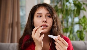 Objavil sa vám vred alebo pľuzgier na pere? Odborníčka prezradila, kedy treba spozornieť