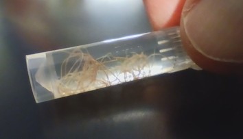 Nenápadný zabijak domácich miláčikov. Veterinári upozorňujú na pľúcne červy