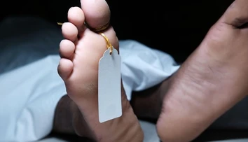 Prípad ako z hororu: Manažér márnice prestížnej univerzity predával časti ľudských tiel. Posielal ich poštou