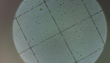 O darovaní spermií alebo vajíčok kolujú medzi Slovákmi rôzne povery. Takáto je pravda