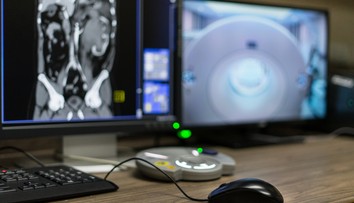 S cudzím predmetom v tele žila šesť rokov: Zabudli jej ho tam pri cisárskom reze