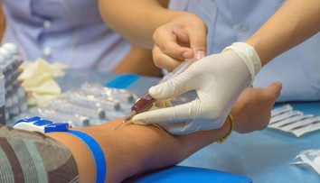 Odber krvi bez stresu: Tipy od odborníkov, ako zvládnuť strach z ihly