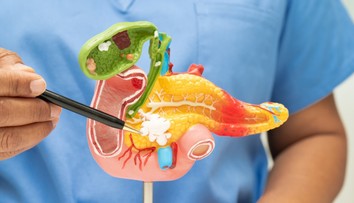 Prelom v liečbe jednej z najzákernejších rakovín. Výsledky prekvapili aj lekárov