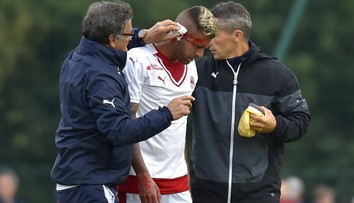 Hororové zranenie, bývalá hviezda AC Miláno prišla o kus ucha