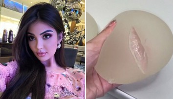 Podstúpila desiatky plastických operácií, teraz všetky ľutuje. Ženy odhovára aj od zväčšovania pŕs