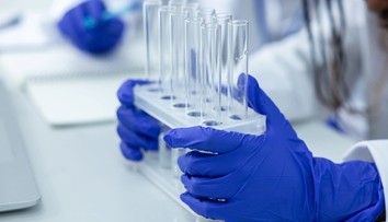 Objavil sa smrteľný vírus, prenášajú ho malé zvieratá. Nemecko hlási už tri obete