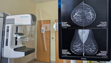 Vedci prišli na prelomový detail. Táto hodina môže zmeniť liečbu rakoviny