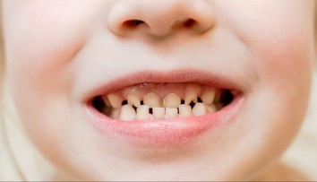 Viete kedy si umyť zuby a kedy sa kefke radšej vyhnúť? Odborníci odhalili správne techniky starostlivosti o chrup