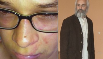 Zvrat v kauze dobitého chlapca. Riaditeľ odstúpil a priznal zlyhanie