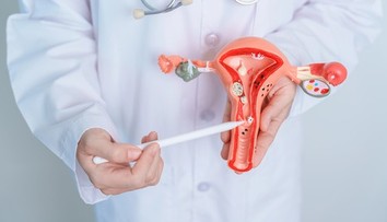 Neinvazívne odstránenie myómov maternice? Inovatívna liečba už je dostupná aj na Slovensku