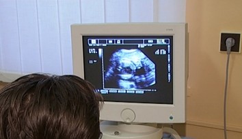 Len 10-ročné dievča z Indie otehotnelo po znásilnení. Súd jej potrat zamietol