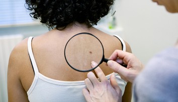 Znamienka netreba podceňovať, môže nás to stáť život