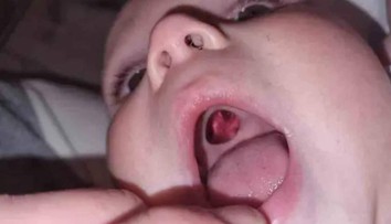 Ženu vystrašila diera v ústach bábätka. Keď sestrička zistila, o čo ide, smiech sa im nezastavil