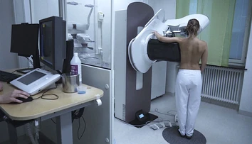 Mamografie sa netreba báť ani ju odkladať: Rakovinu prsníka odhalí aj roky pred prvými príznakmi