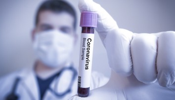 Vedci objavili osem nových vírusov. Obávajú sa ďalších epidémií