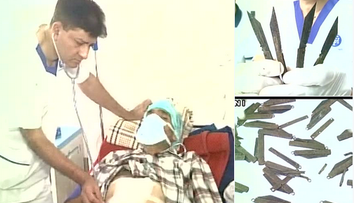 Policajtovi odstránili zo žalúdka 40 nožov, ktoré prehltol